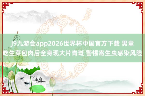 J9九游会app2026世界杯中国官方下载 男童吃生菜包肉后全身现大片青斑 警惕寄生虫感染风险